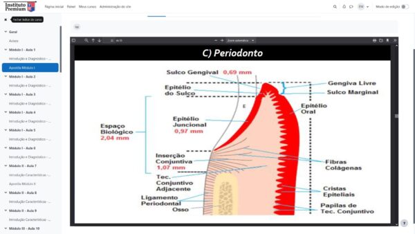 alinhador invisivel premium curso
