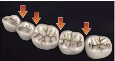 relações interproximais dos dentes